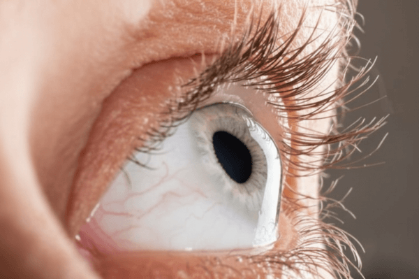 Tratamento de Crosslinking em Campinas